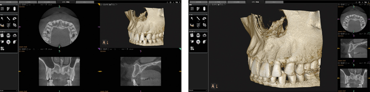 レントゲン写真